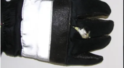 Handschuh mit Riß im Obermaterial (Finger)